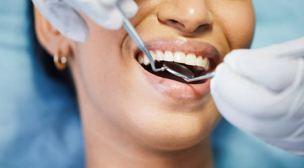 Best Teeth Whitening  in White Oak, TX